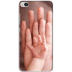 Coque Xiaomi Mi 5s personnalisable