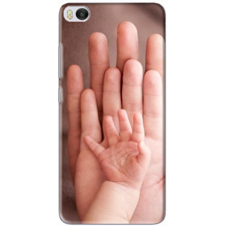 Coque Xiaomi Mi 5s personnalisable