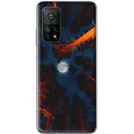 Coque Xiaomi Mi 10T personnalisable